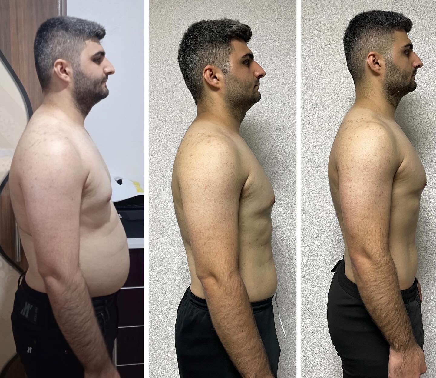 Before After Transformation 6